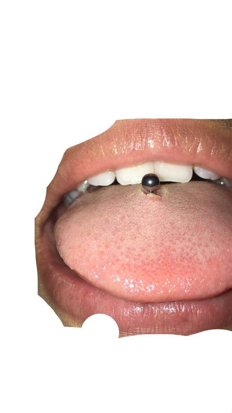 Nesting tongue piercing - Can rings nest? While nesting is normally specific to stud style jewelry in oral piercings, some clients find that a comfortable fit ring also leaves small indent. Not the same pocket …